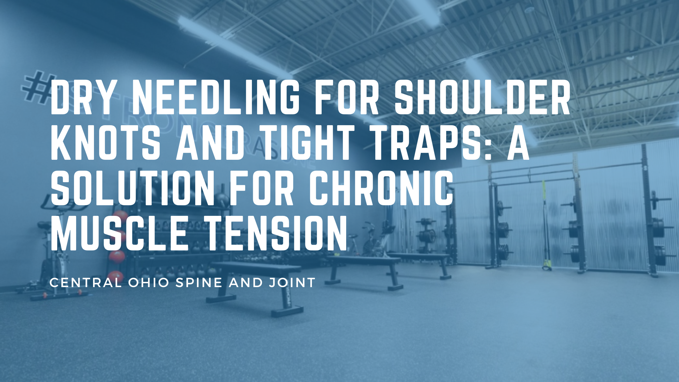 Dry Needling for Shoulder Knots and Tight Traps: A Solution for Chronic Muscle Tension in Columbus and Westerville, Ohio