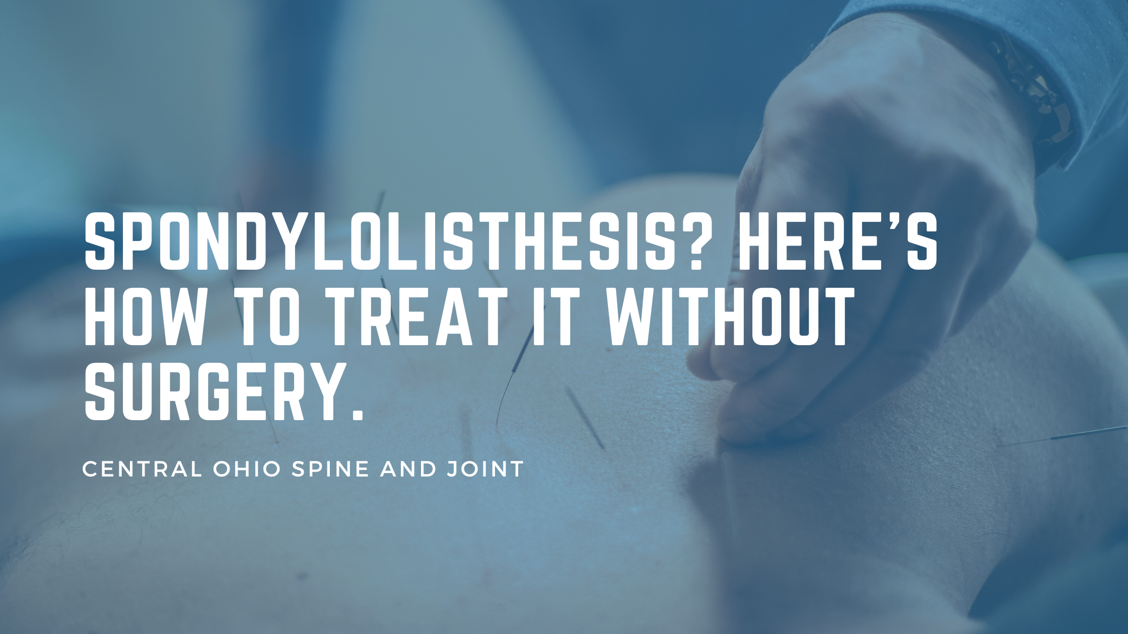 Spondylolisthesis: Causes, Grading, Symptoms, and Comprehensive Treatment Options