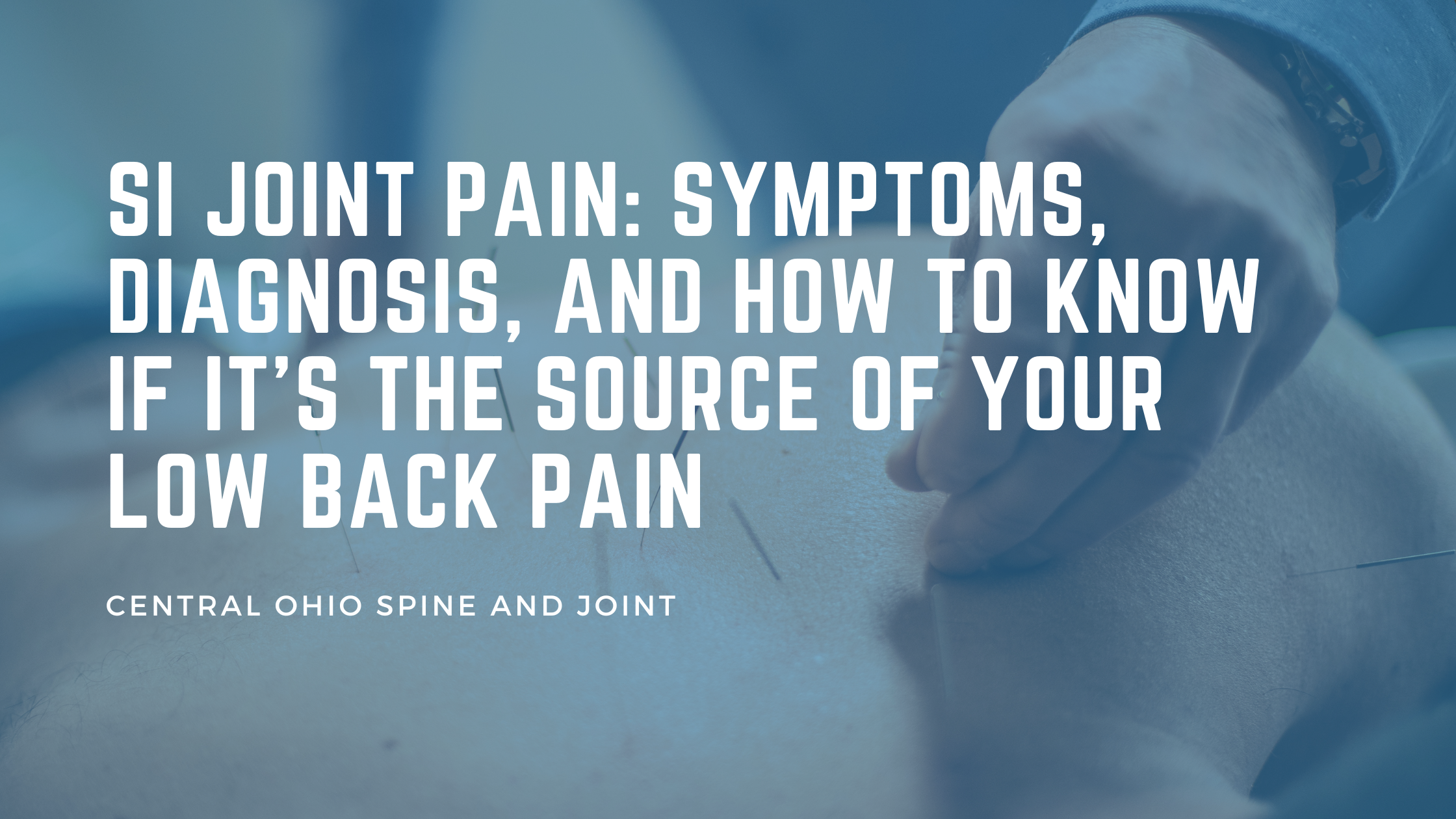 Understanding SI Joint Pain: Symptoms, Diagnosis, and Clinical Insight