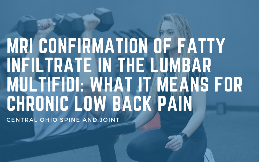 MRI Confirmation of Fatty Infiltrate in the Lumbar Multifidi: What It Means for Chronic Low Back Pain