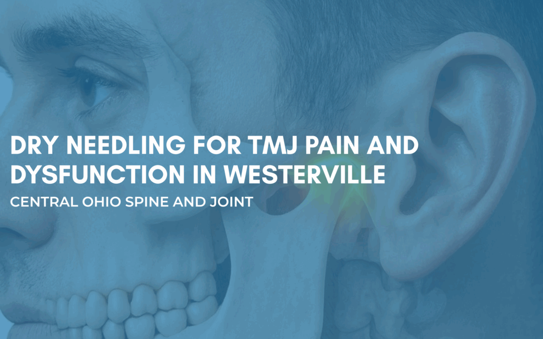 Dry Needling for TMJ Pain and Dysfunction in Westerville