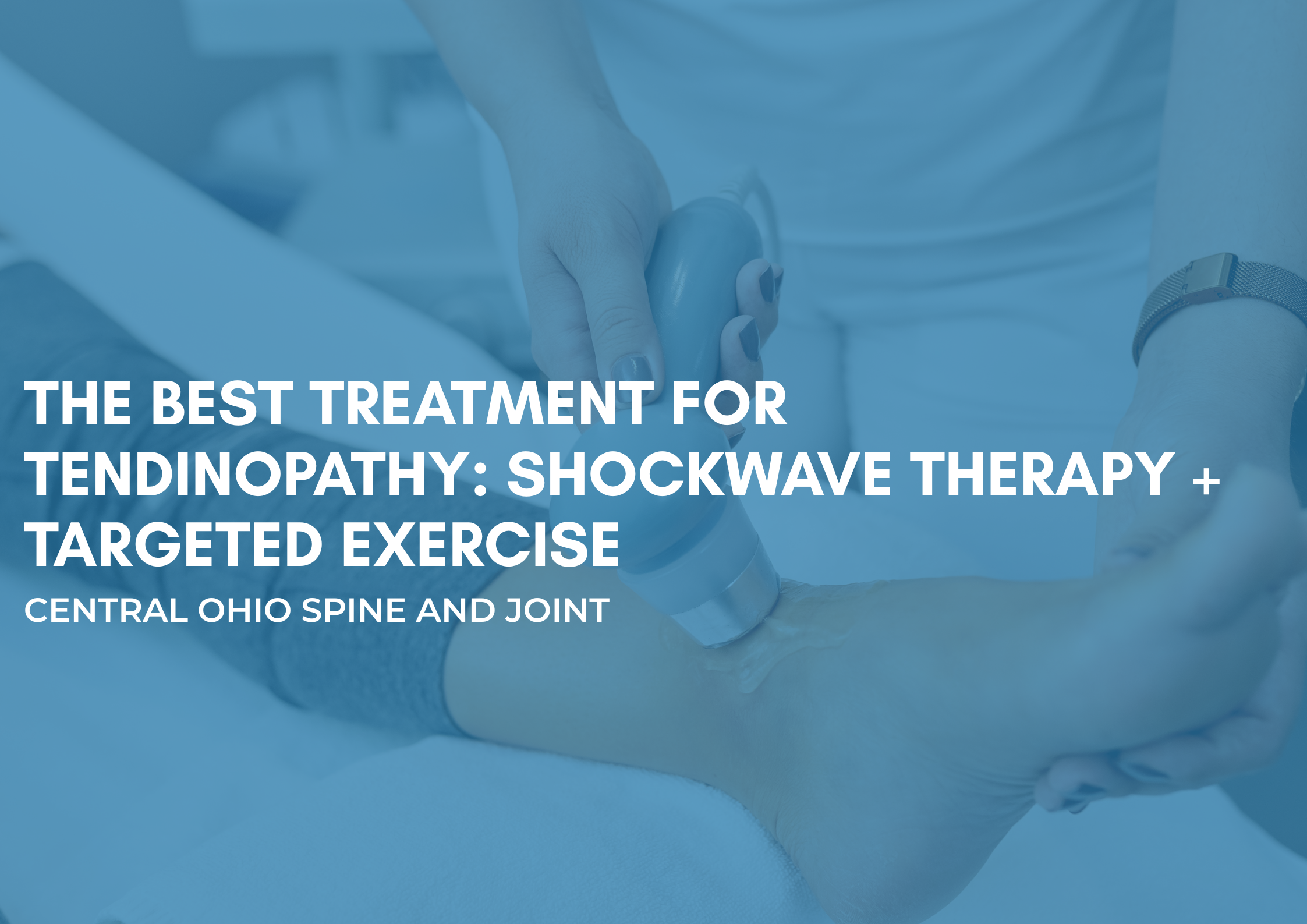 The Best Treatment for Tendinopathy: Shockwave Therapy + Targeted Exercise