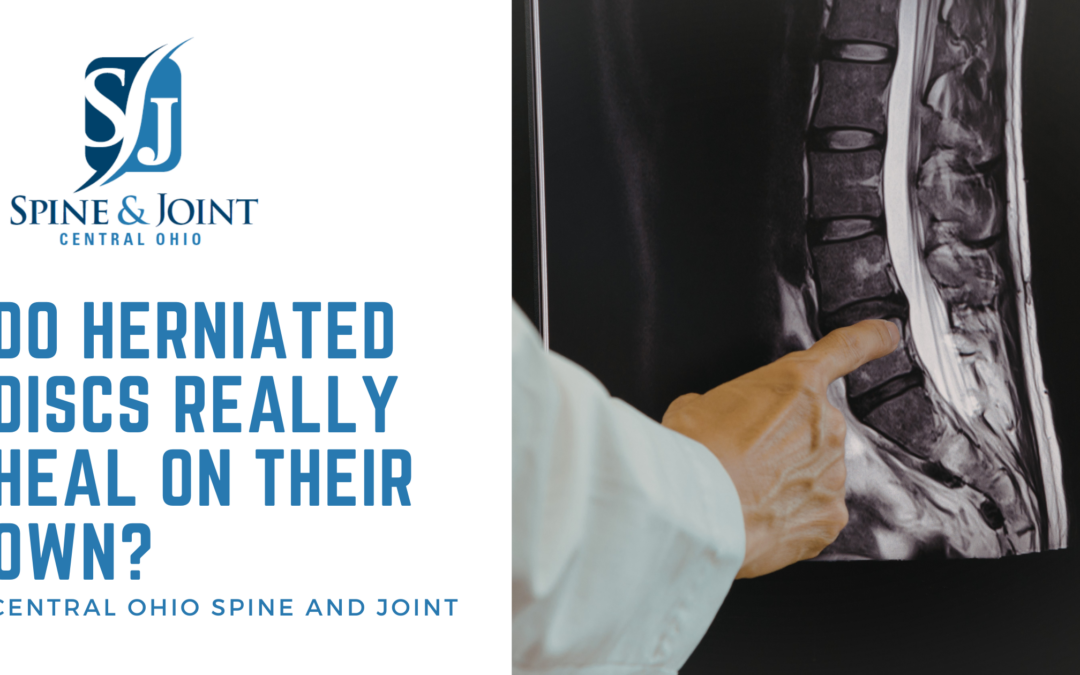 Do Herniated Discs Really Heal on Their Own? Disc herniation reabsorption rates and more.