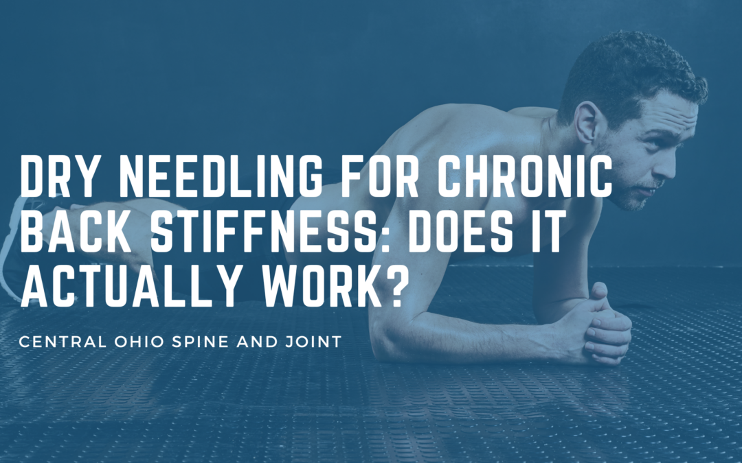 Dry Needling for Chronic Back Stiffness: Does It Actually Work?